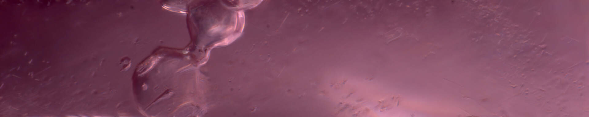 Inclusion of apatite in ruby from Tanzania